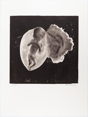 Lot 179 - LENNART NILSSON (1922–2017)